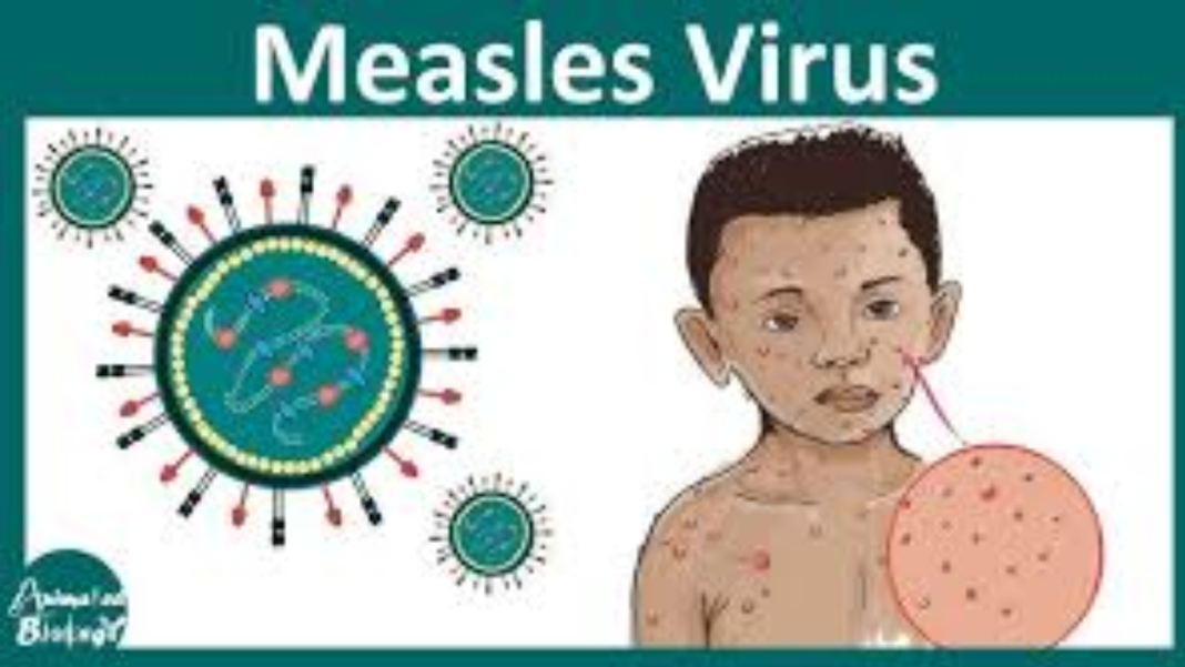 Measles virus